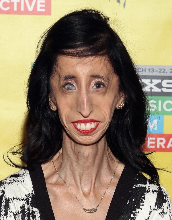 Lizzie Velasquez